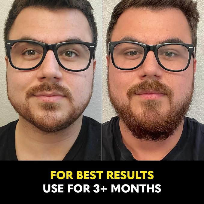 Beard Growth Vitamins